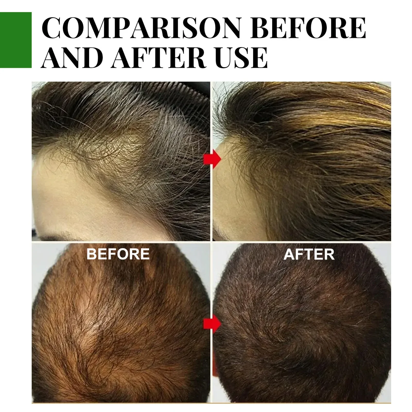 Huiles essentielles de romarin pour la croissance des cheveux, huiles essentielles naturelles pures de 30ML pour nourrir les cheveux brillants et sains 2